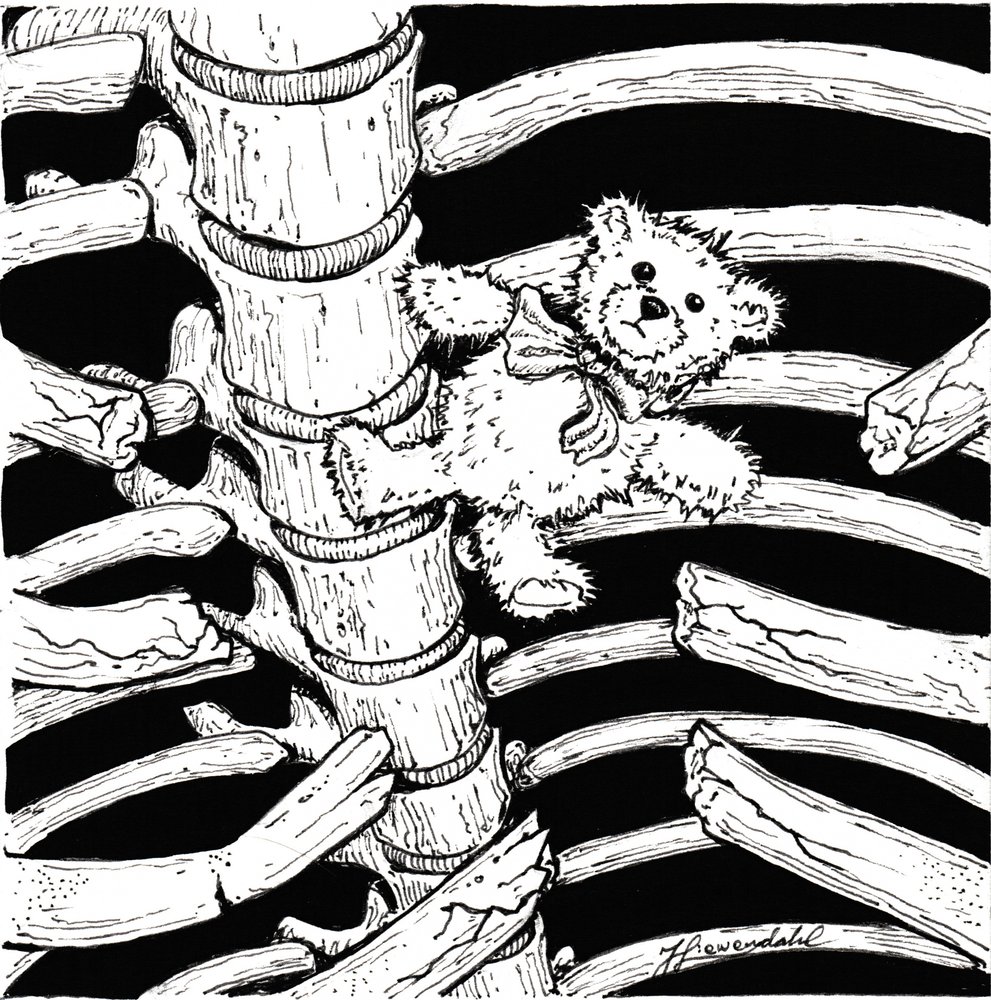 Skelettierter Teddybär von Johan Liewendahl