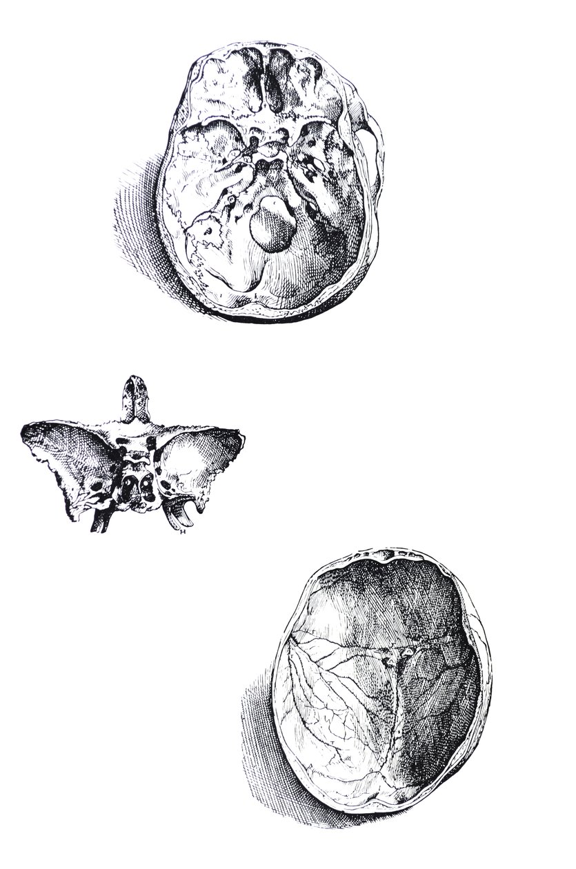 Die Tafeln aus dem ersten Buch der De Humani Corporis Fabrica von Andreas Vesalius