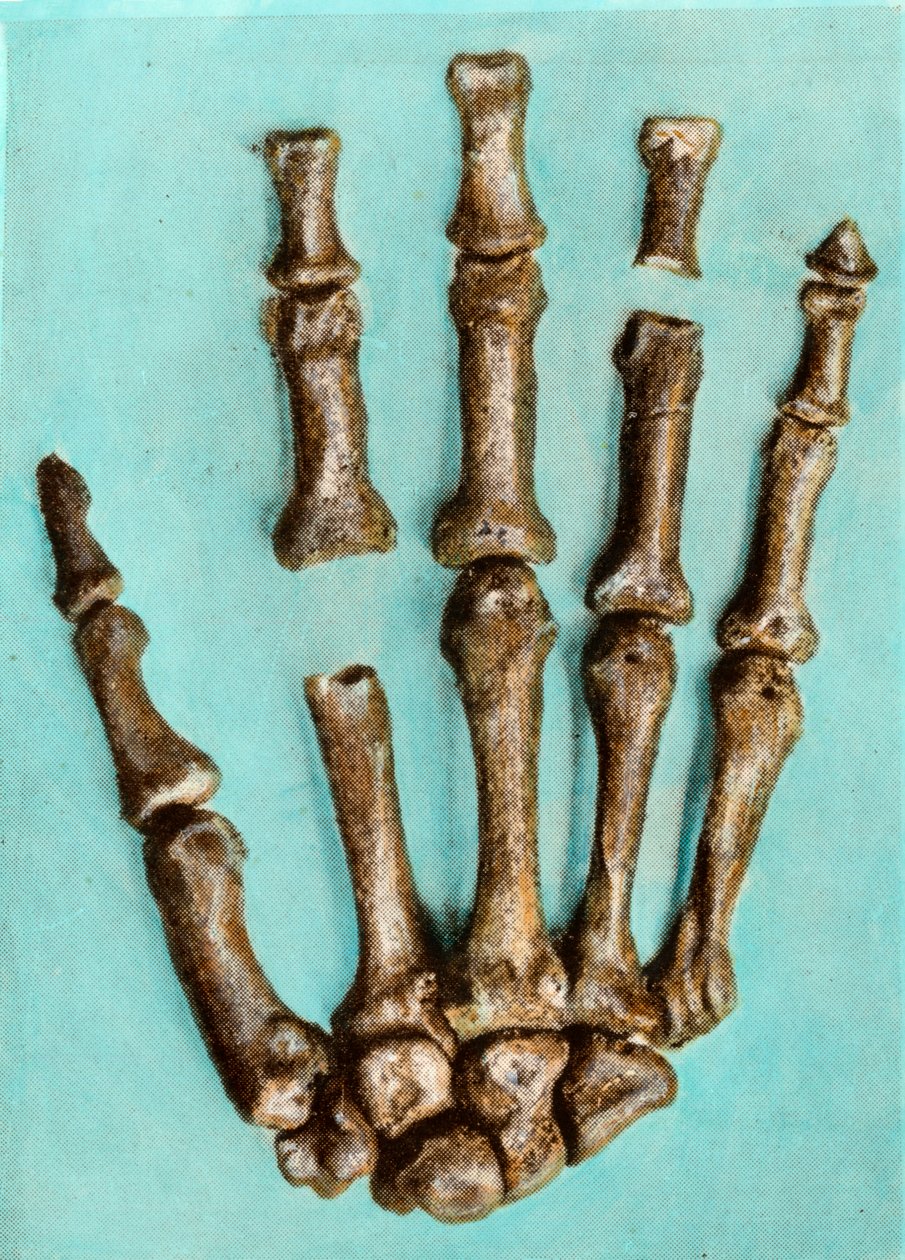 Rechte Hand eines Frauenskeletts von der prähistorischen Stätte Ferrassie in der Dordogne aus dem Mittelpaläolithikum. Gravur von Anonymous Anonymous
