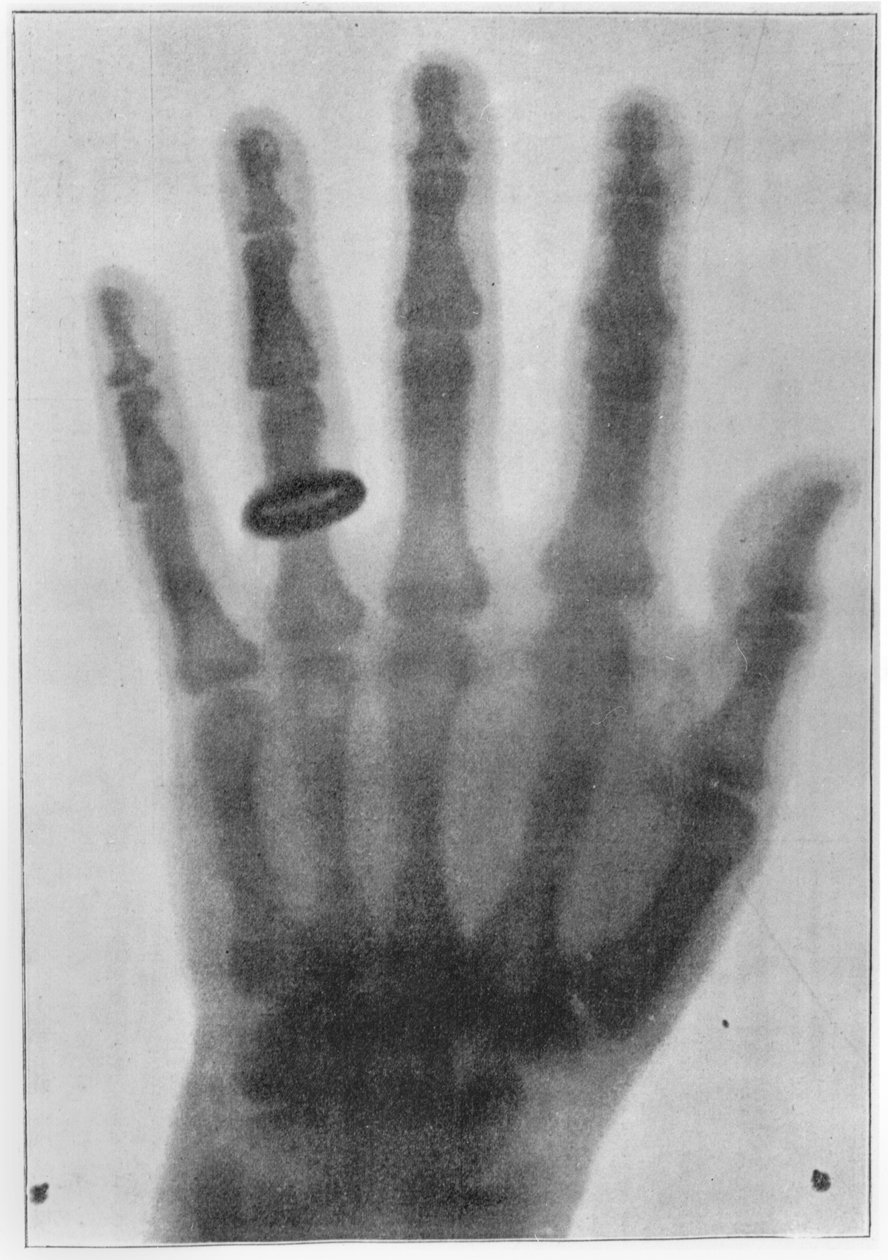 Röntgenaufnahme der linken Hand von Anna Bertha Ludwig, Röntgens Frau von Carl August Voller