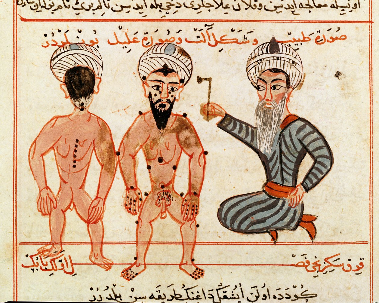 Ms Sup Turc 693 fol.46v Kauterisierung von Lepra-Läsionen, 1466 von Charaf ed Din