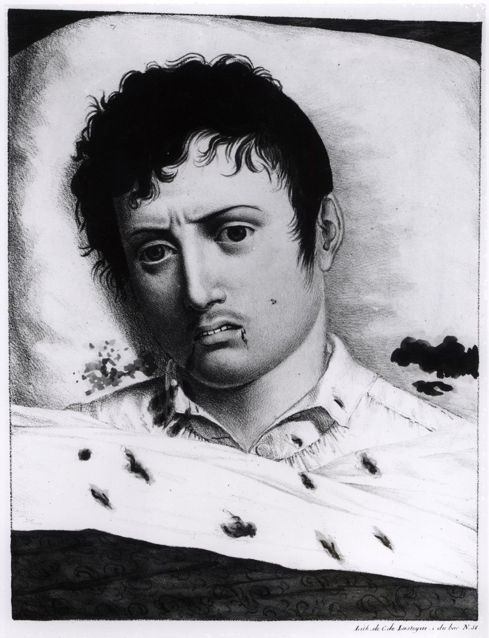 Beobachtung des Gelbfiebers, ca. 1819 von Charles Lasteyrie du Saillant