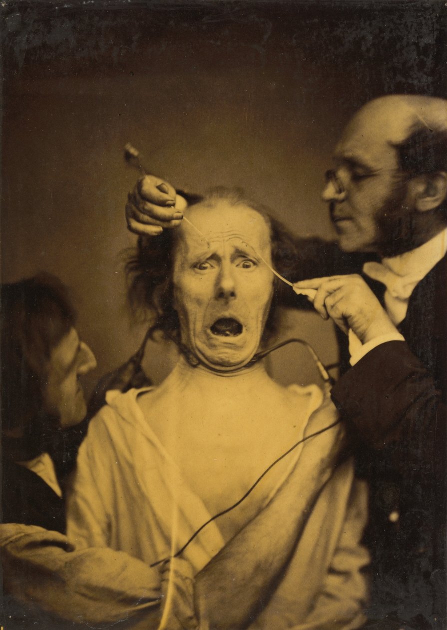 Terror gemischt mit Schmerz, Folter, 1854-1856, gedruckt 1862 von Duchenne de Boulogne