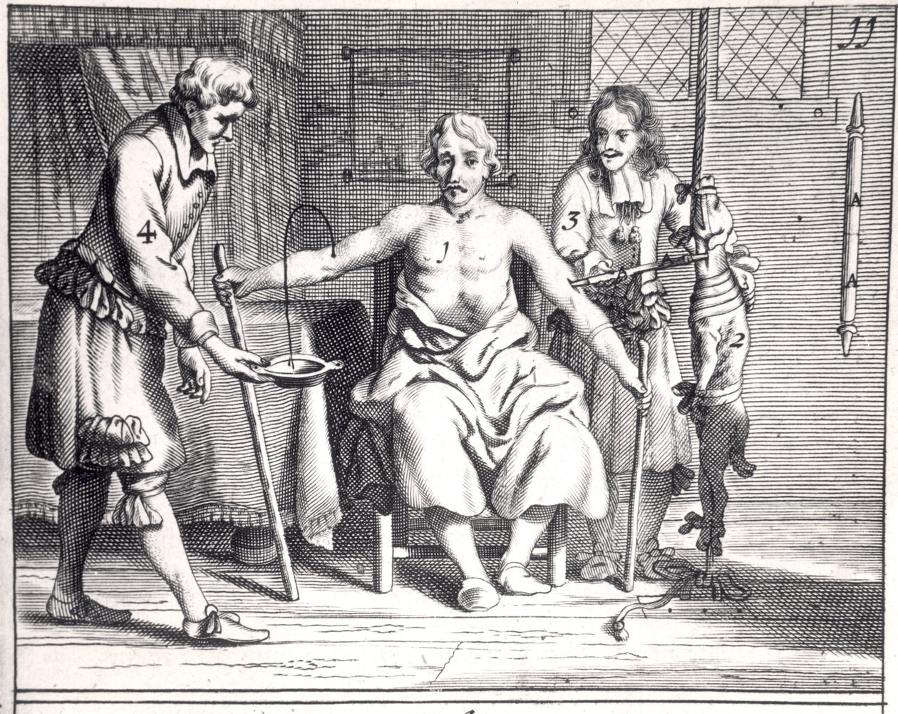 Bluttransfusion von einem Hund, aus Armamentarii Chirurgici von Johannes Schultes, veröffentlicht in Amsterdam, 1671 von Dutch School