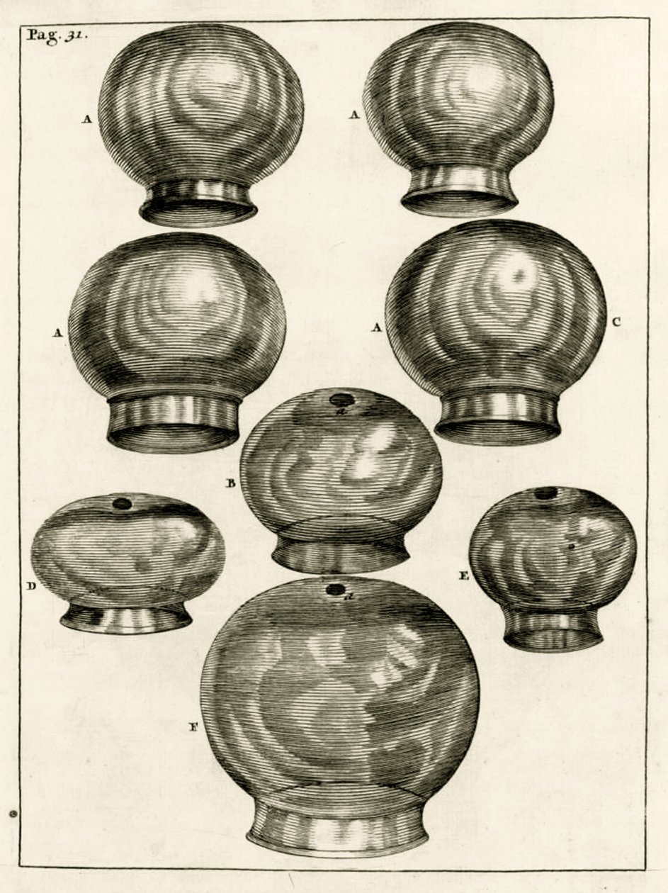 Verschiedene Schröpfgläser, aus Exercitationes Practicae circa Medendi Methodum von Frederik Dekkers, 1694 von Dutch School