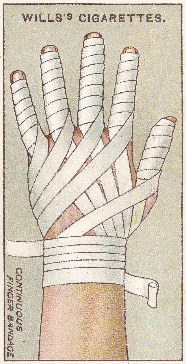 Durchgehender Fingerverband, Nr. 48 aus der Erste-Hilfe-Serie von Willss Zigarettenkarten, 1913 von English School