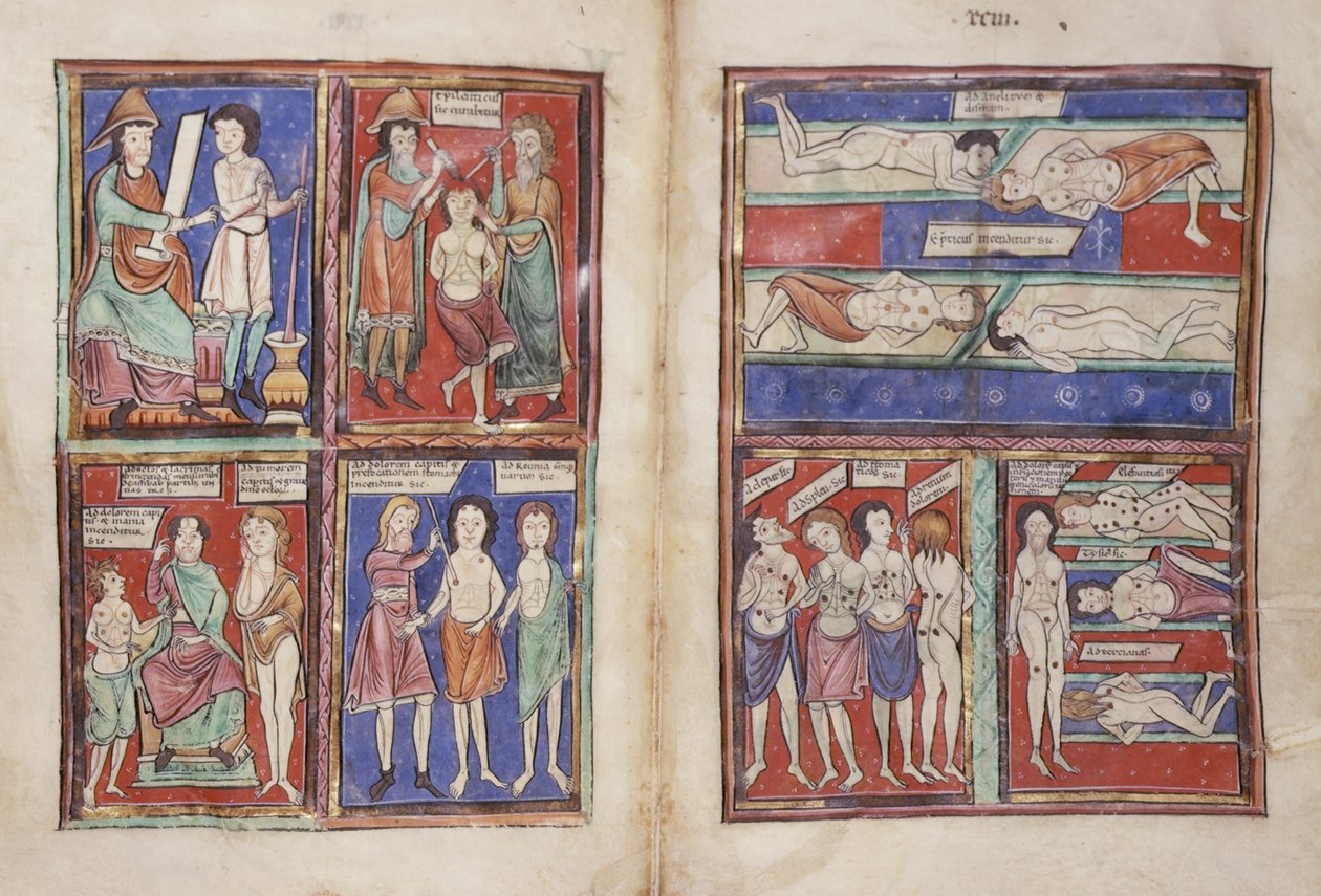 Sloane 1975 fol.91v-92 Medizinische Szenen von English School