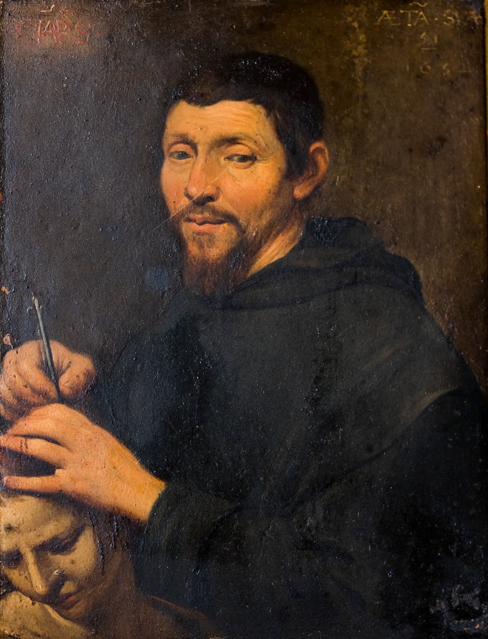 Ein Geistlicher führt die Trepanation durch von Flemish School