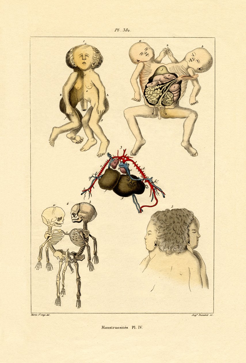 Freak von French School