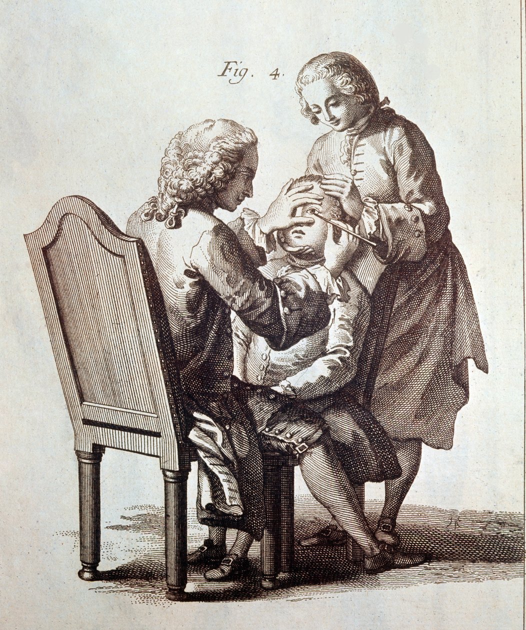 Ein Arzt operiert einen Katarakt-Patienten, Illustration aus der Medizinischen Enzyklopädie von Denis Diderot und Jean le Rond d