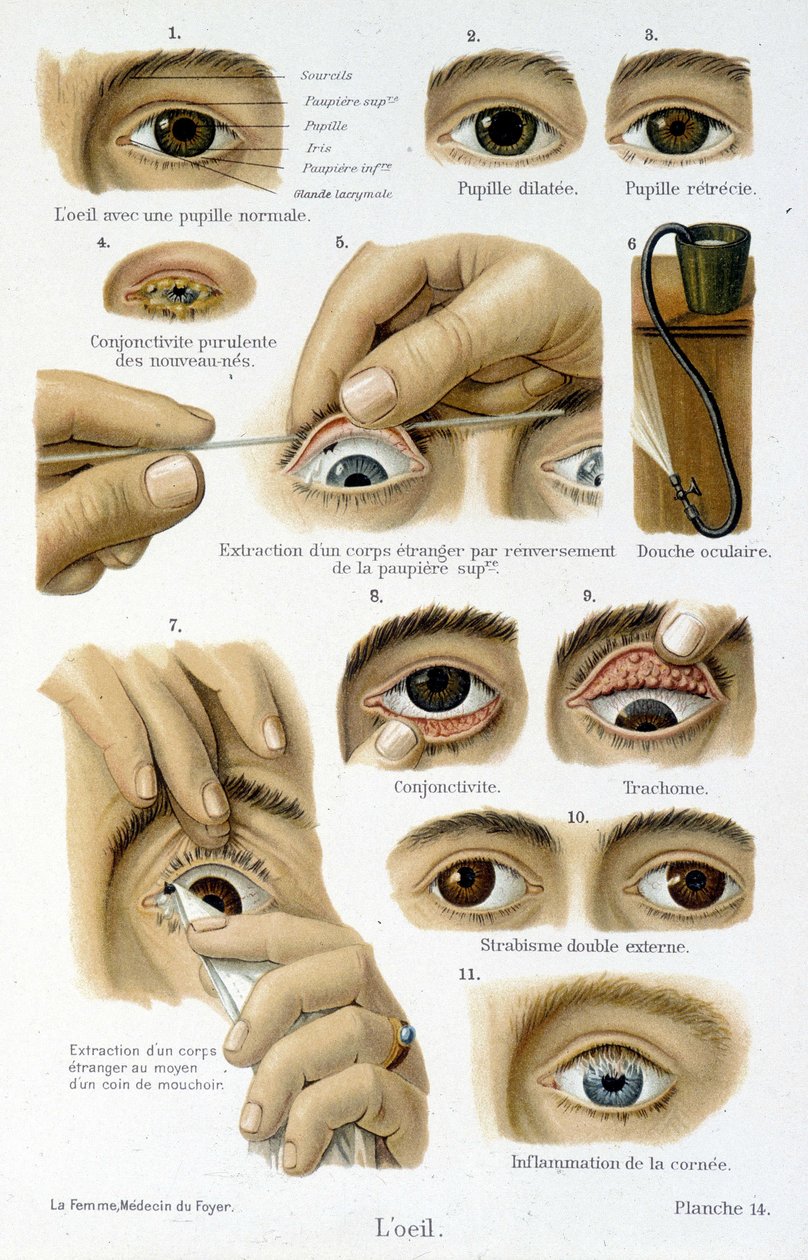 Medizin: das Auge von French School
