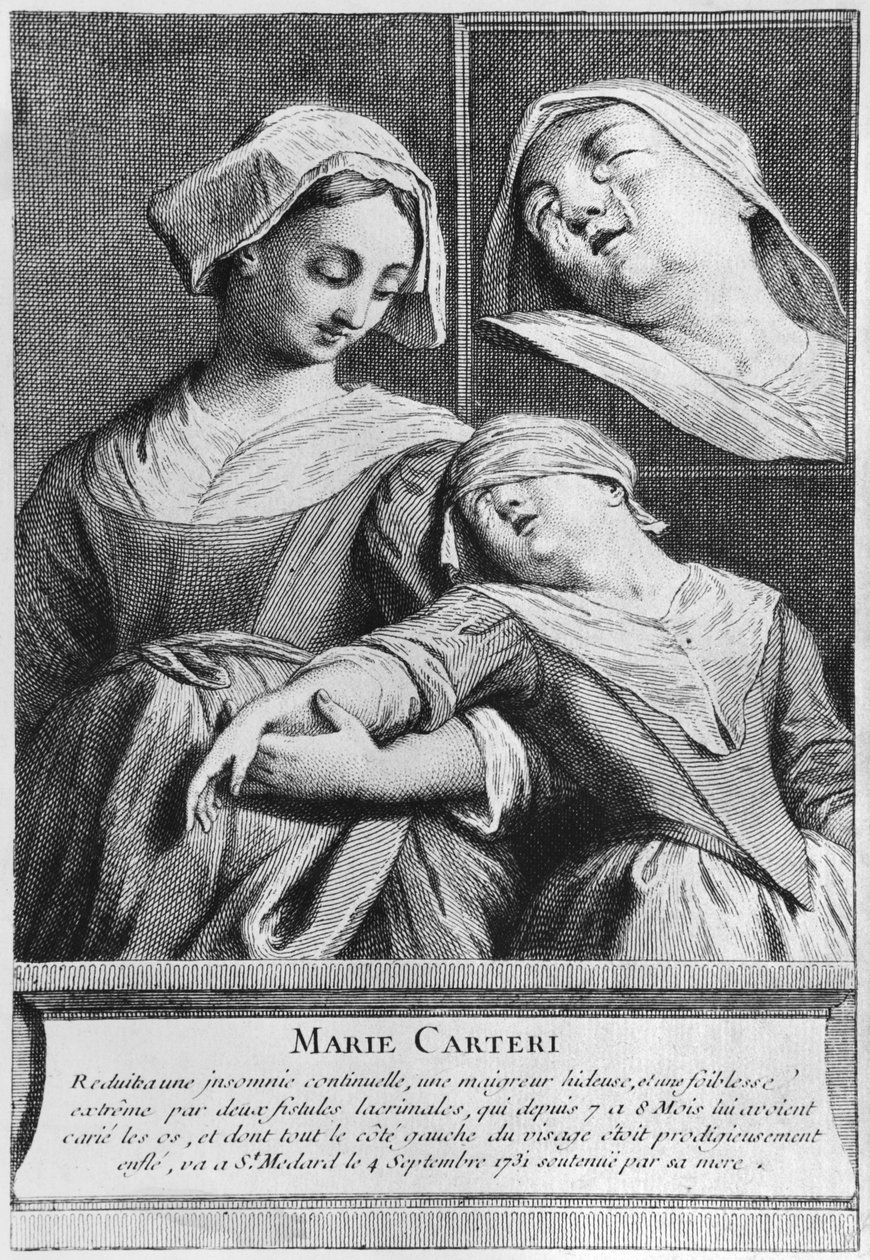 Wundersame Heilung einer blinden Frau, Marie Carteri, am Grab von Diakon François de Paris auf dem Pfarrfriedhof Saint-Médard in Paris von French School