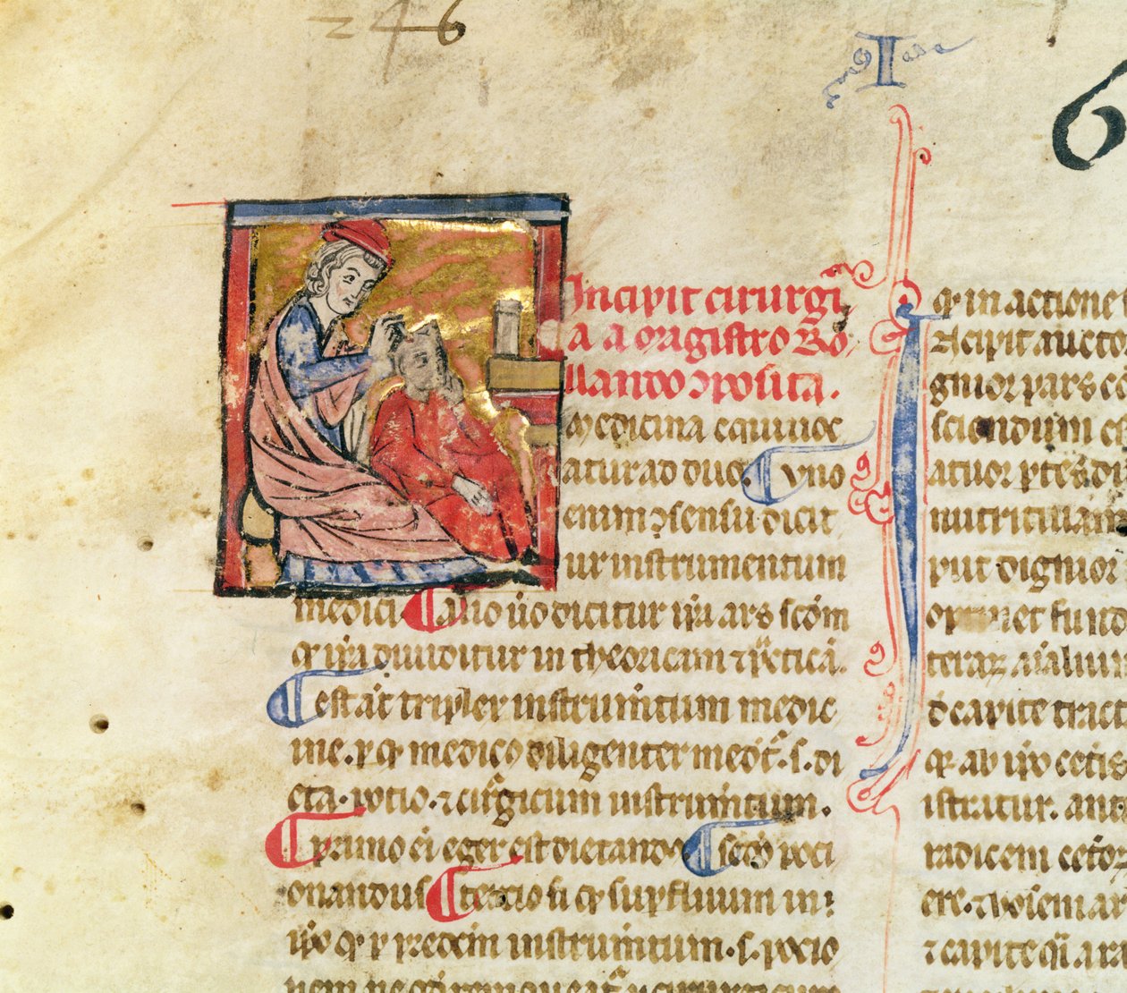 Ms Lat. 7134 fol.1 Trepanation, aus Chirugie de Maitre Rolandi von French School