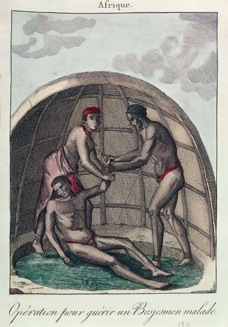 Operation zur Heilung eines kranken Buschmanns, 1811 (Farbstich) von French School