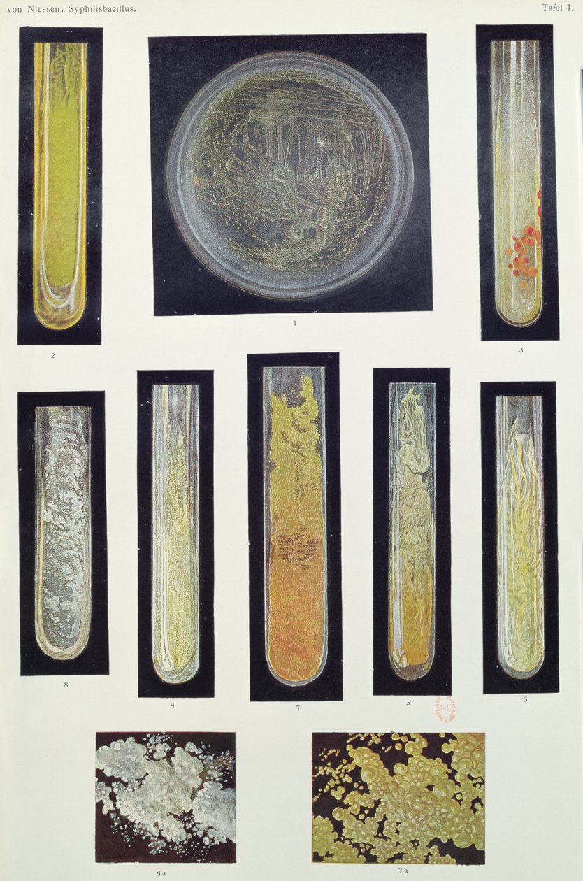 Syphilus Bacillus, aus einem Buch von Max von Niessen, Leipzig, 1908 von German School