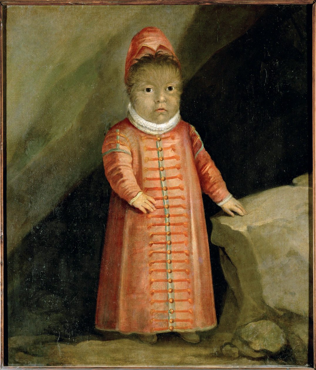 Der Sohn von Petrus Gonzalvus wurde 1596 untersucht von German School