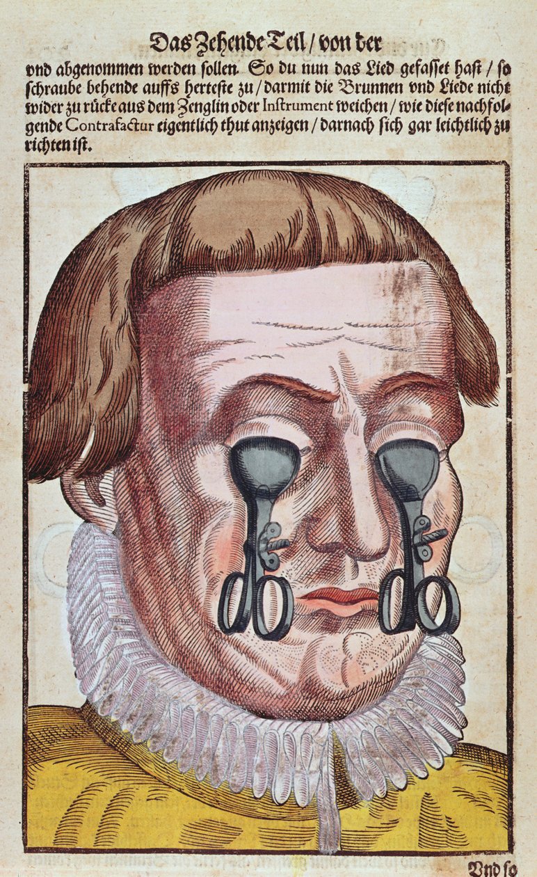 Behandlung einer Augenkrankheit, aus Ophthalmodouleia von Georg Bartisch (1535-1636) veröffentlicht in Dresden 1583 (Farbholzschnitt) von German School
