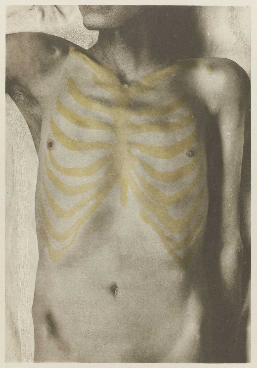 Anatomische foto van een mannelijk lijk: 