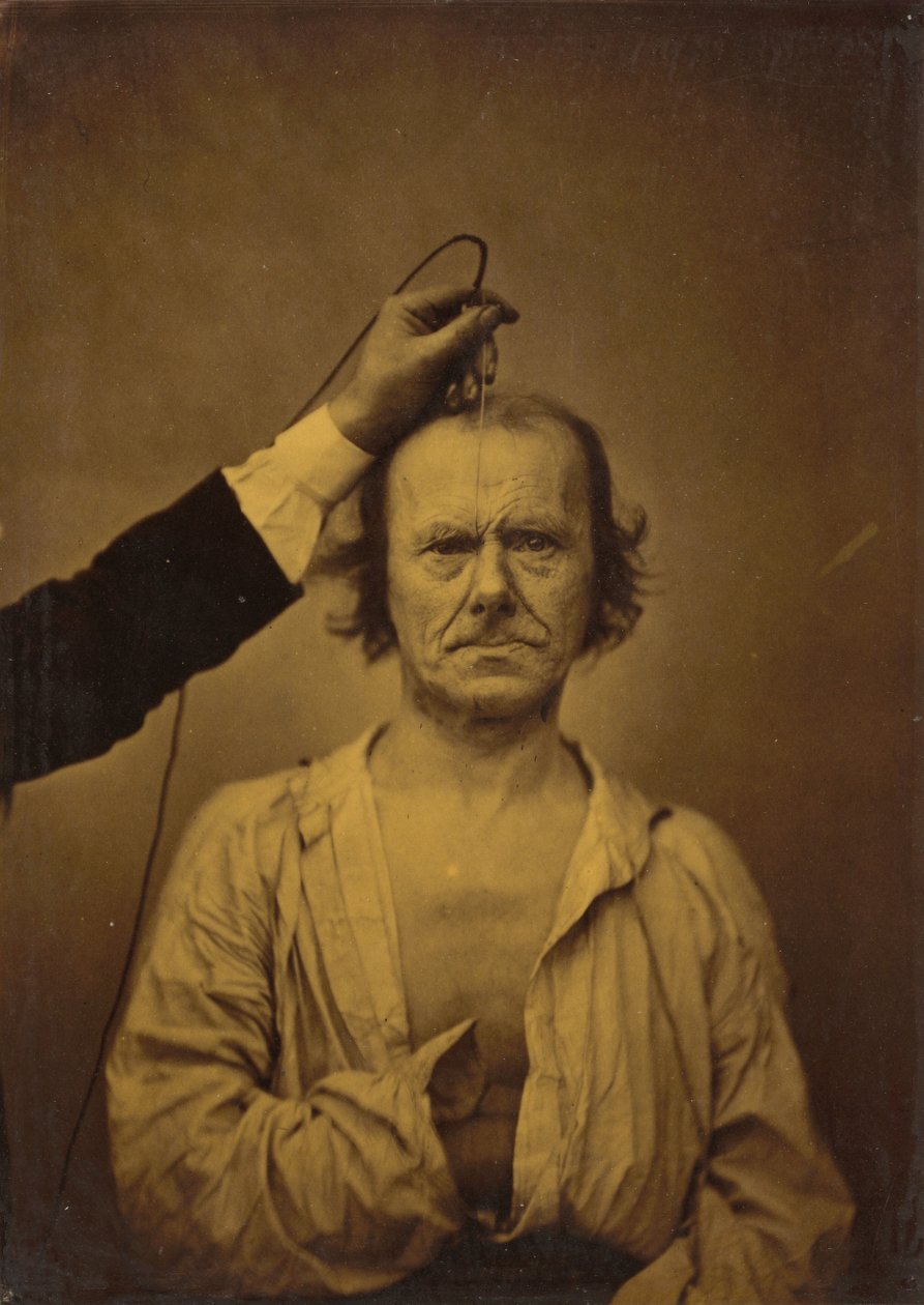 Aufmerksamkeit (links); Strenge, Aggression (rechts) von Guillaume Benjamin Armand Duchenne de Boulogne