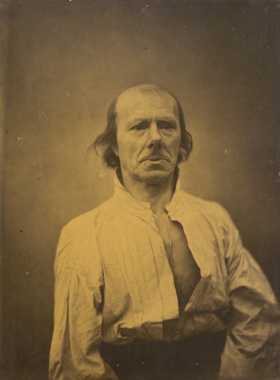Gesicht in Ruhe, 1854-1856, gedruckt 1862 von Guillaume Benjamin Armand Duchenne de Boulogne