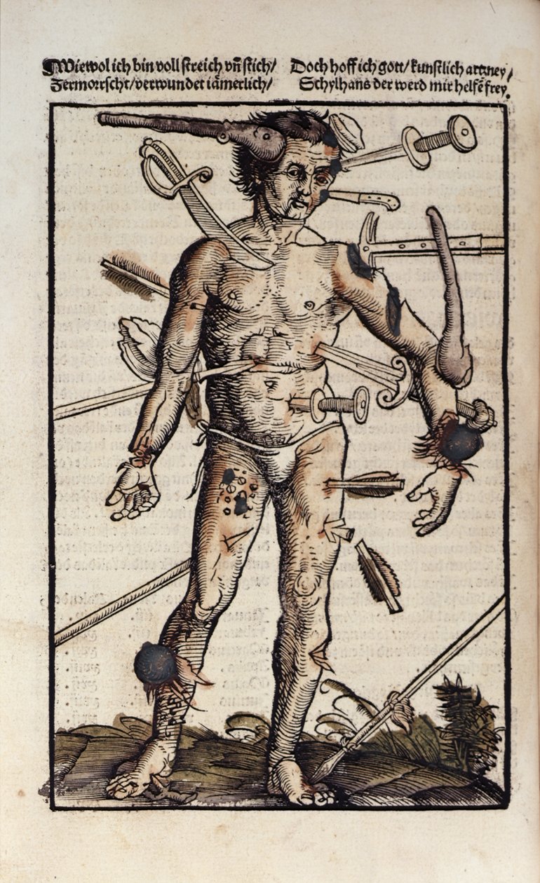 Der Wundmann, aus dem 