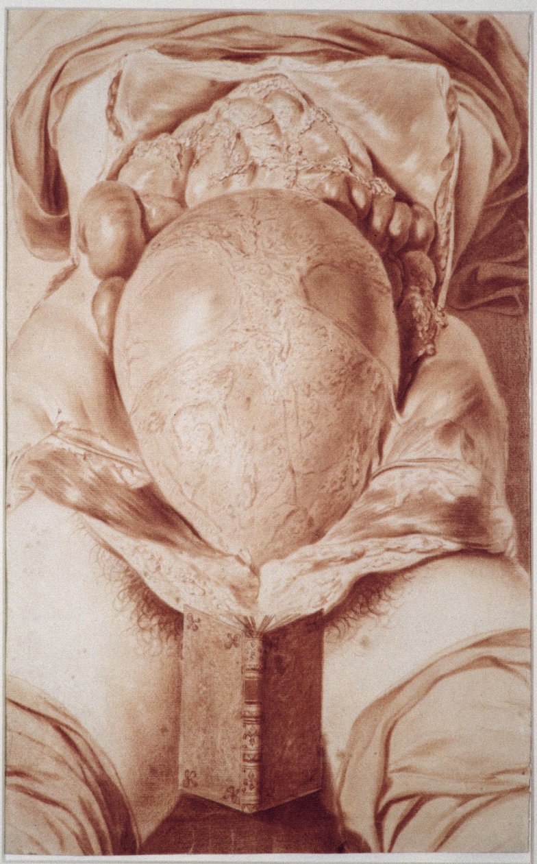 Tafel XXVI Zeichnung aus William Hunters 