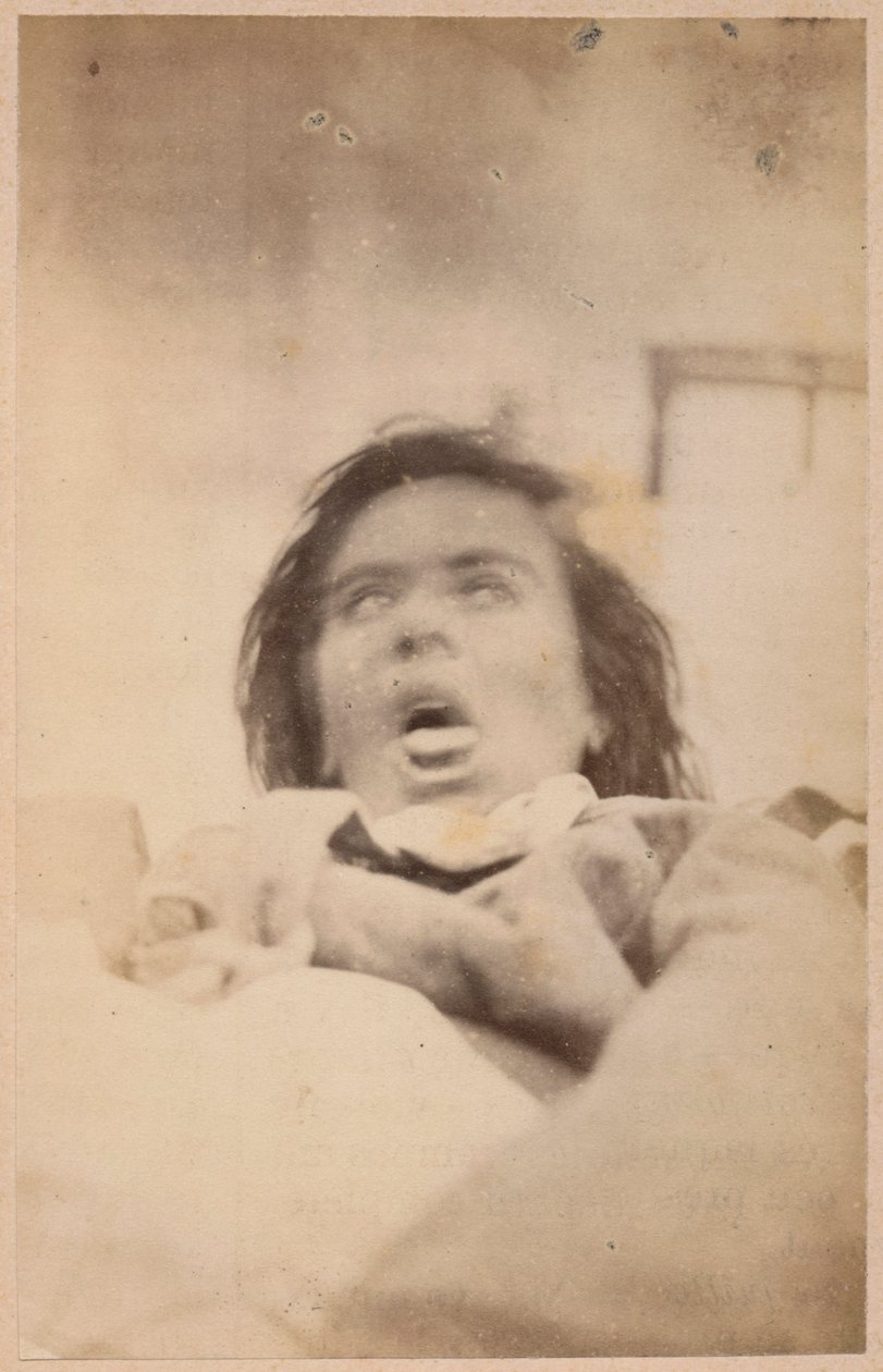 Hysterische Epilepsie, Halluzinationen, Angst, Tafel XXIX aus 