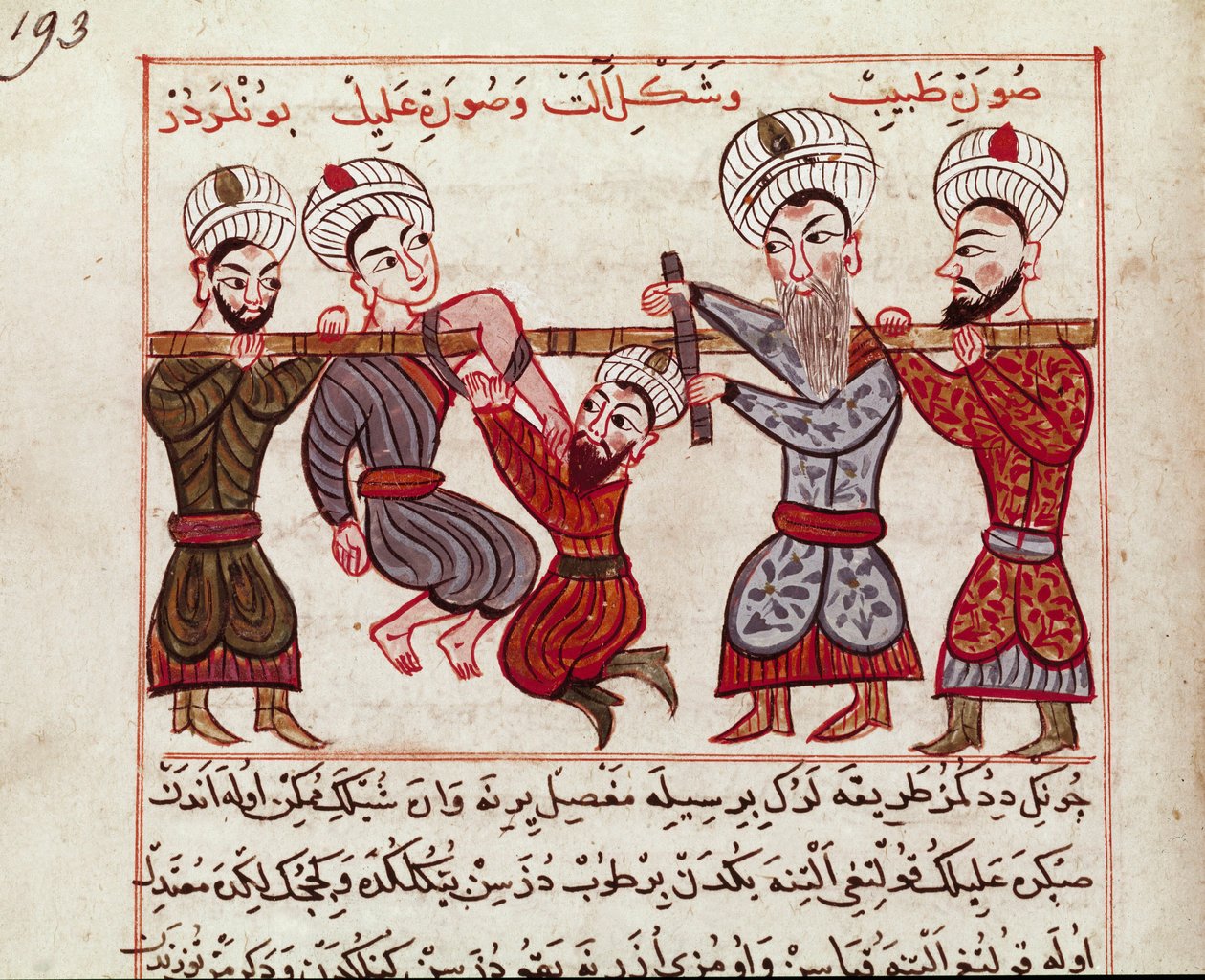 Medizin: orthopädischer Eingriff. Miniatur aus einer türkischen Medizinabschrift von Charaf-ed-din (1404-1468) nach „La Chirurgie Imperiale“ (Ms Sup Turk 693 fol. 193) 1466 Paris, B.N. von Persian School