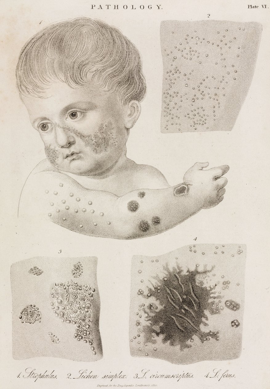 Dermatologie Arten von Hautkrankheiten von John Pardon