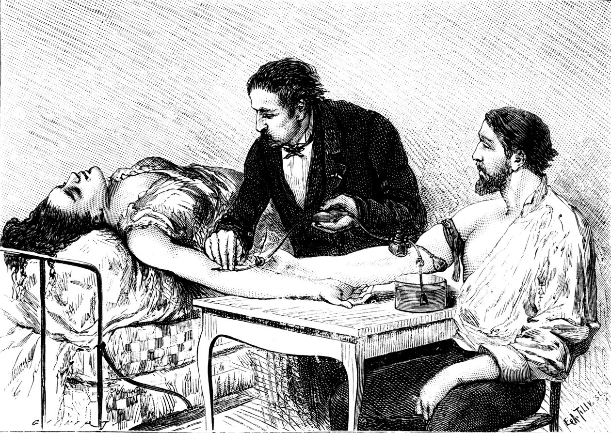 Dr. Roussell aus Genf führt eine direkte Bluttransfusion von einem Freiwilligen an eine Frau durch, 1882 von Unbekannt