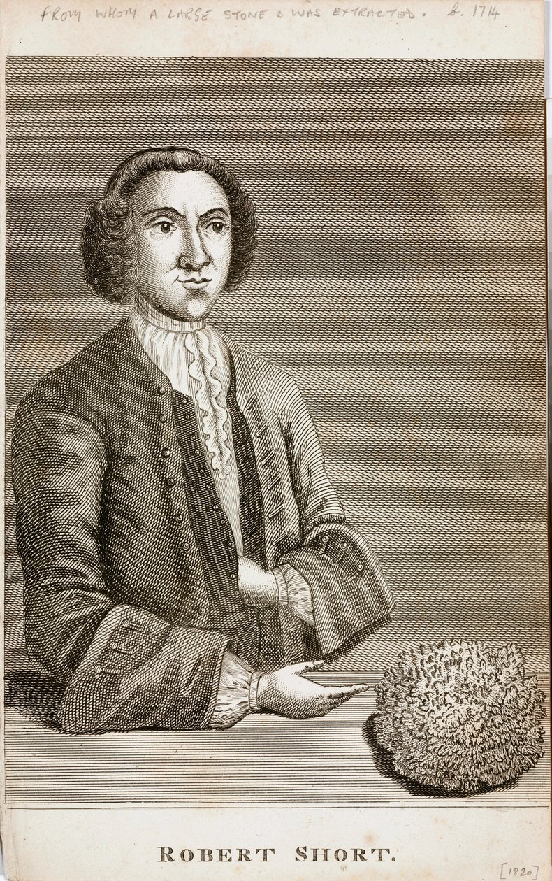 Robert Short, medizinische Kuriosität, ca. 1750er von Unbekannt