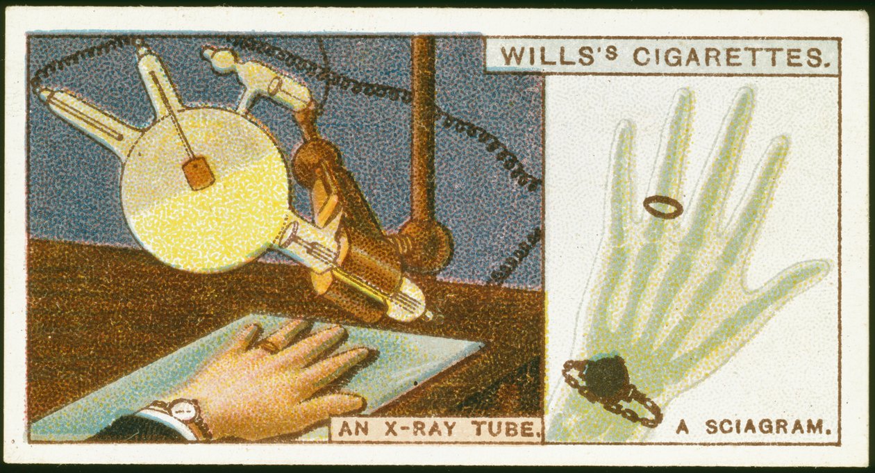 Röntgenaufnahme der Hand, 1924 von Unbekannt