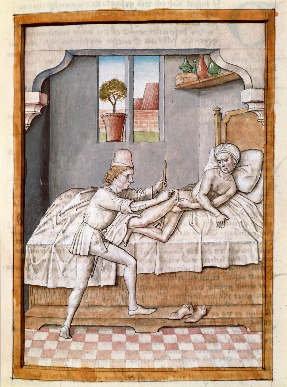 Ein Arzt behandelt einen Patienten (Miniatur aus einer deutschen Übersetzung der Fabeln von „Kalila und Dimna“ von Bidpai, um 1480) von Unknown artist