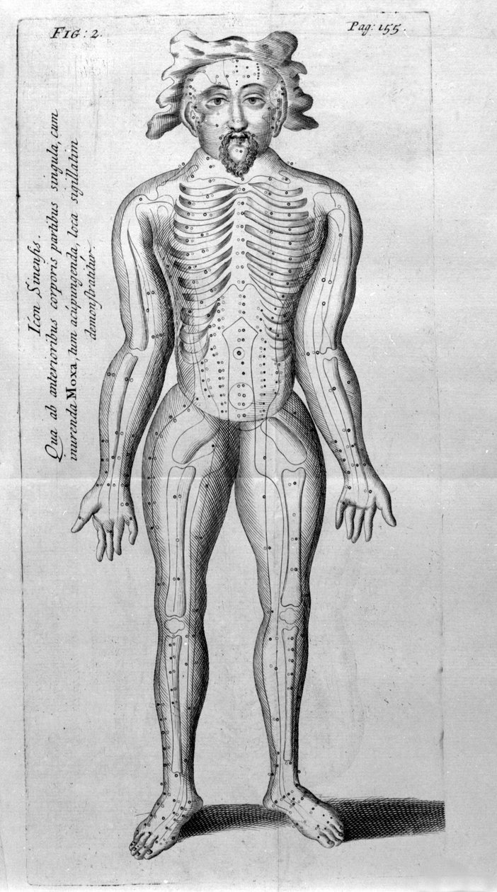 De Acupunctura von W. Ten Rhijne. London 1683. Erster westlicher Text über Akupunktur von Unknown artist