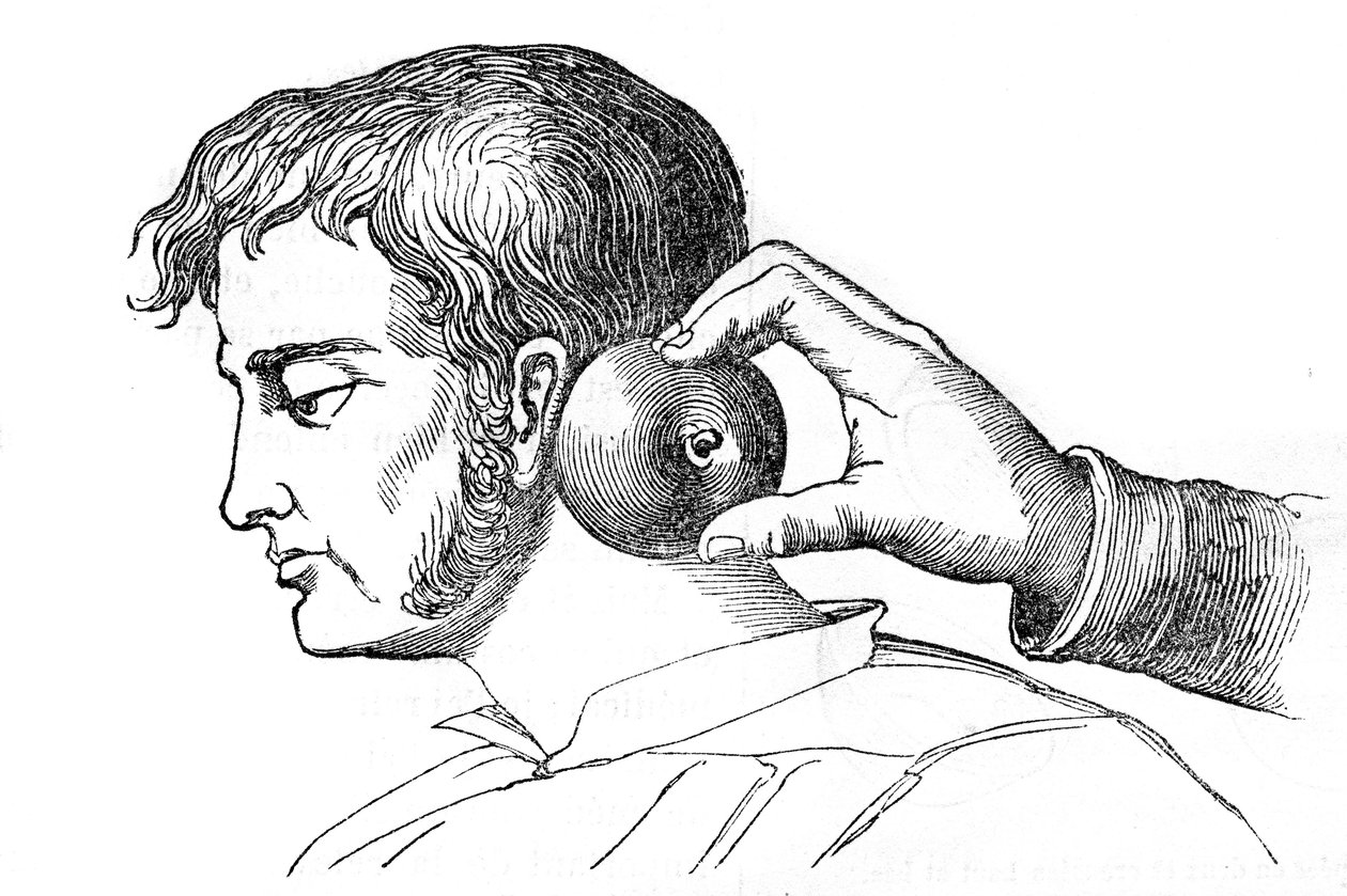 Lokale Blutegelbehandlung - Anwendung von Blutegeln mit einem Apfel - Gravur in „La Santé Universelle - Guide Médical des Familles“ 1852 von Unknown artist