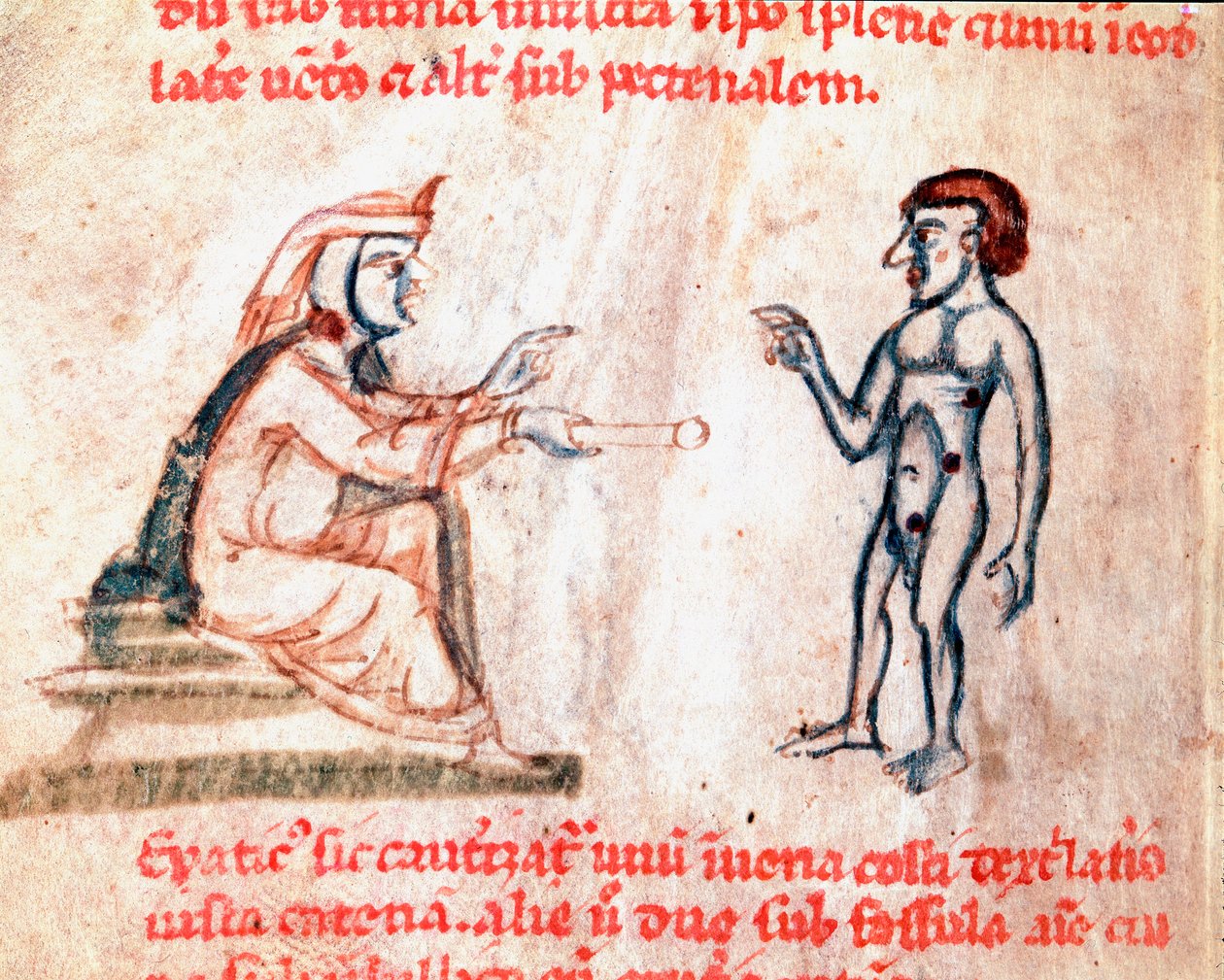 Der Arzt brennt den Patienten an schmerzhaften Stellen mit heißen Eisen. Miniatur aus dem Manuskript „De Medicina cauteriorum secundum Brunum, Rugerium et Rolthe“ 13. Jahrhundert Paris, B.N. von Unknown artist