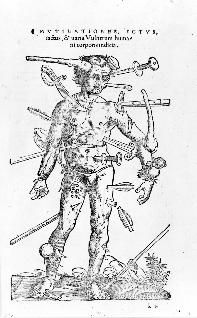 Alle Arten von traumatischen Kriegsverletzungen. 16. Jahrhundert von Unknown artist