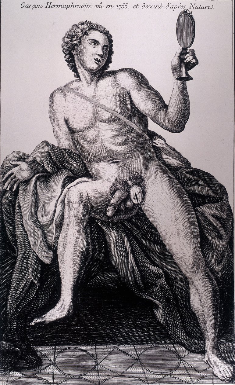 Hermaphroditischer Junge, gesehen 1755 und nach der Natur gezeichnet von Unknown artist