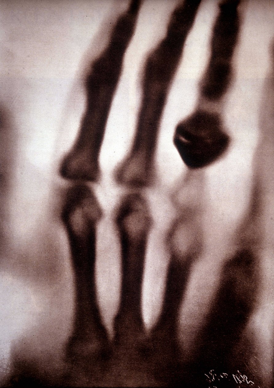 Röntgenstrahlen oder X-Strahlen Erstes Foto: die Hand von Röntgens Frau. 22.12.1895 von Unknown artist