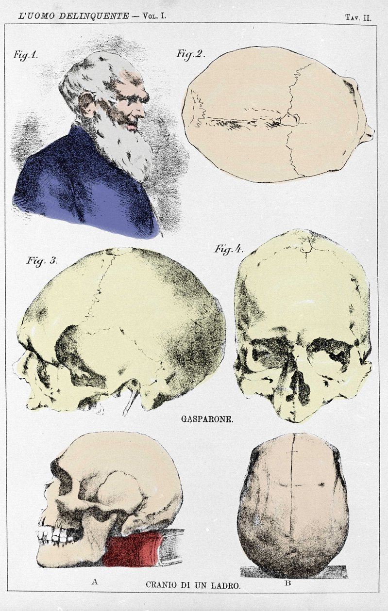Studie über die Morphologie eines delinquenten Schädels durch den italienischen Kriminologen von Unknown artist