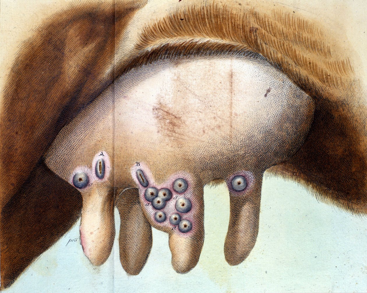 Die Brust der Kuh, die von Luigi Sacco (1769-1836) im Januar 1801 zur Pockenimpfung verwendet wurde. Medizinische Tafel aus „Vaccination Treat“ von Luigi Sacco, Mailand. von Unknown artist
