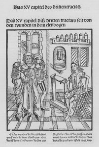 Das Buch der Chirurgie von Hieronymus Brunschwig von (after) German School