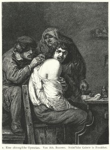 Die Rückenoperation von Adriaen (after) Brouwer