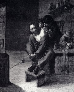 Die chirurgische Operation. Gravur nach einem Gemälde von Adrien Brauwer (gestorben 1608) 17. Jahrhundert