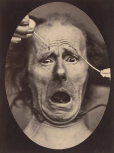 Elektro-Physiologie, Figur 64
