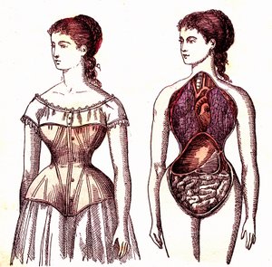 Korsettkompression - Normales Leben und Gesundheit von J. Rengade. Zeichnung A. Demarle 1881