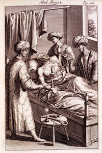 Illustration der Moxibustion aus Medicina Aegyptorum von Prospero Alpinus, 1745 von American School