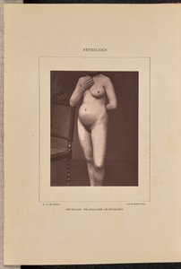 Generalisierte vesikulöse Syphilis von Arthur de Montmeja