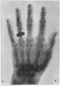 Röntgenaufnahme der linken Hand von Anna Bertha Ludwig, Röntgens Frau von Carl August Voller
