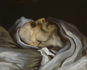 Théodore Géricault auf seinem Sterbebett von Charles Emile Callande de Champmartin